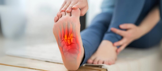 Fascitis Plantar: ¿Qué es? Cómo prevenirla? Síntomas y ejercicios